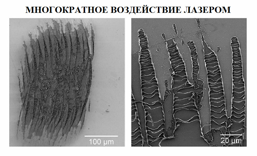 Многократное воздействие лазером